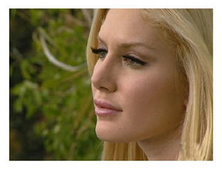 Heidi Montag cosmetic surgery: she talks about following in Michael Jacksons footsteps. Horrifying? No big deal? 